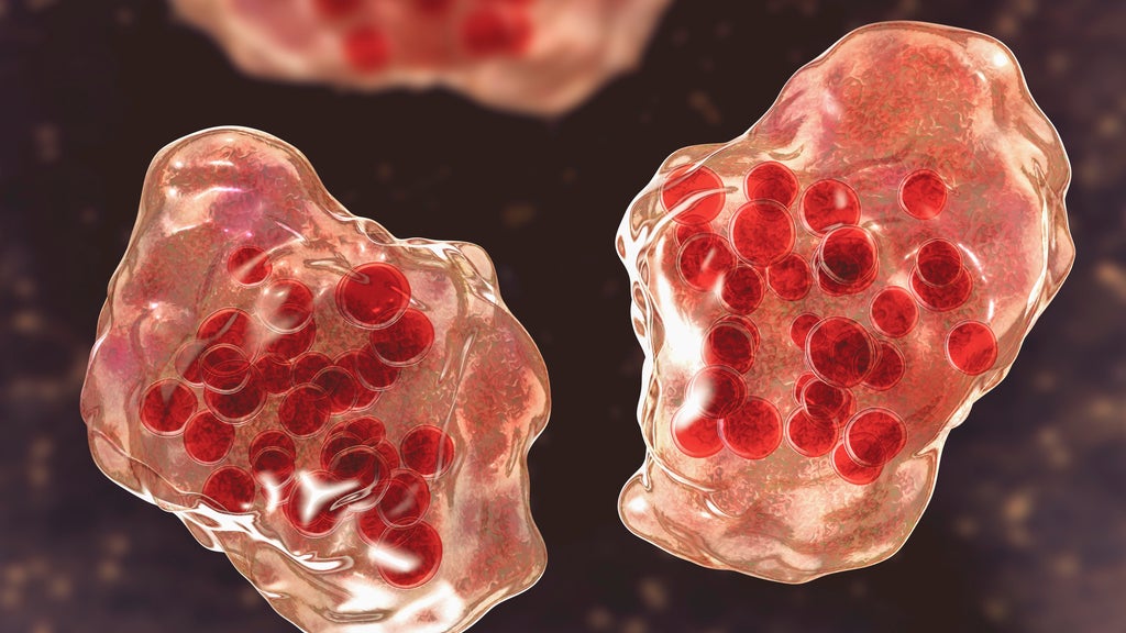 Central Minnesota county reports "several cases of suspected measles" — WCCO / CBS Minnesota, Apple Valley Health news