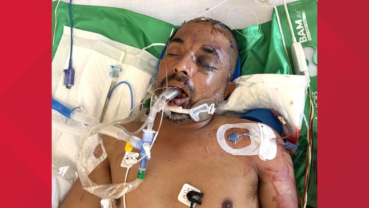 University Hospital asks for help identifying unconscious patient hit by truck Saturday evening — KENS 5 (San Antonio), Apple Valley Health news