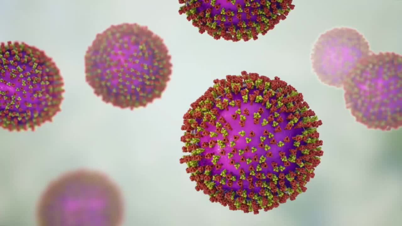 Wisconsin measles outbreak rises to 267 cases as spread continues — FOX 9
