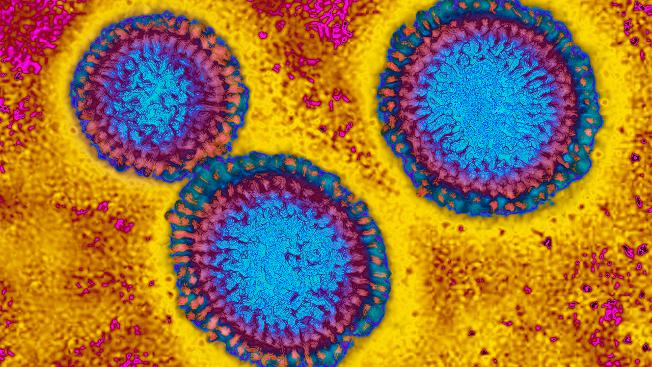 Flu hospitalizations 'slightly higher' than usual, officials urge vaccinations — FOX 9
